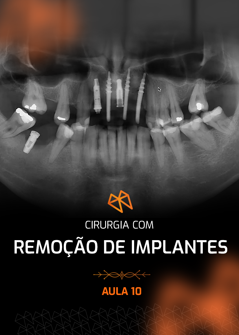 FPM 10 - CIRURGIA COM REMOÇÃO DE IMPLANTES