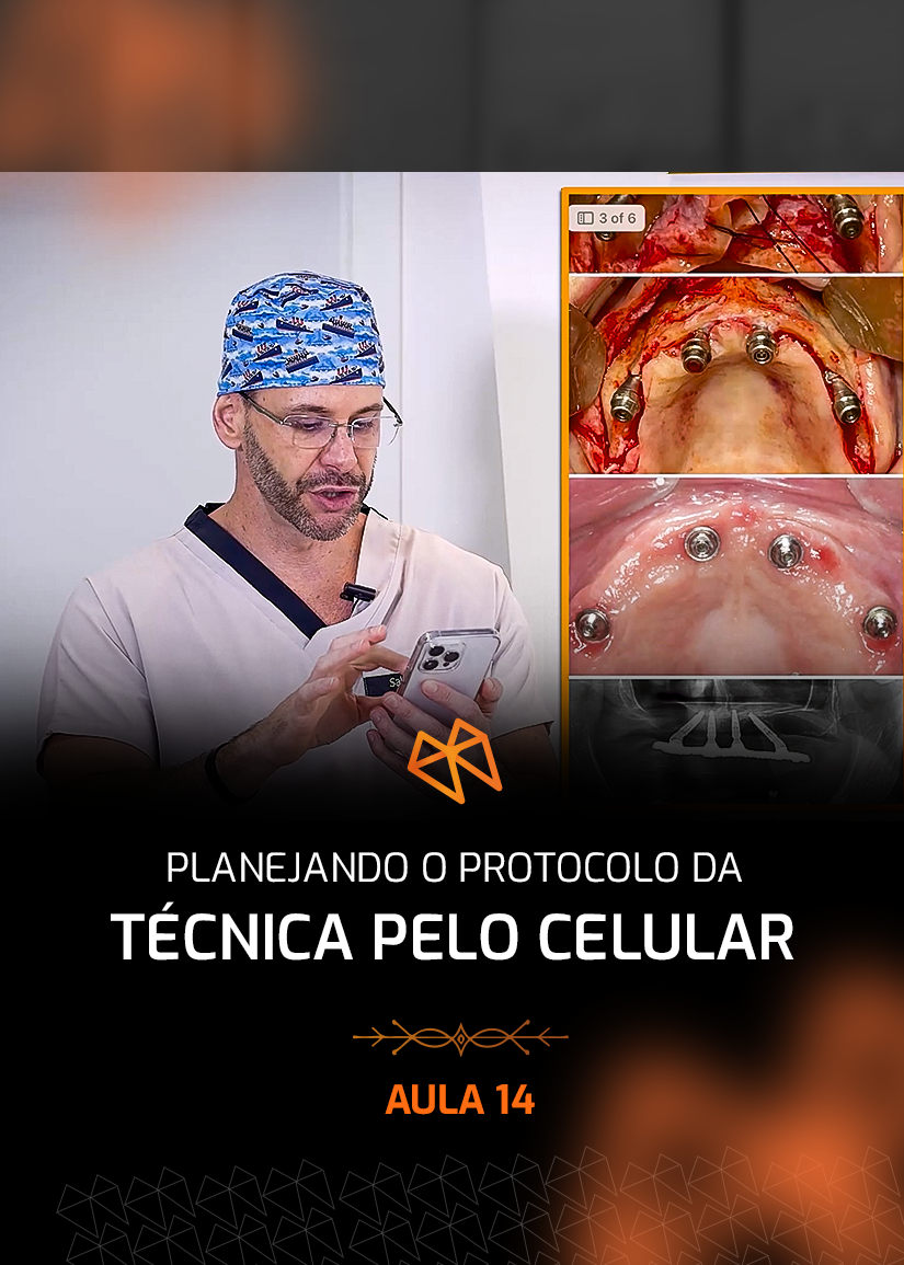 FPM 14 - PLANEJANDO O PROTOCOLO DA TÉCNICA PELO CELULAR