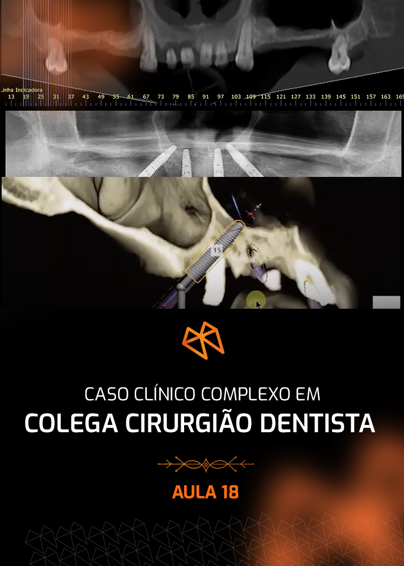 FPM 18 - CASO CLÍNICO COMPLEXO EM COLEGA CIRURGIÃO DENTISTA