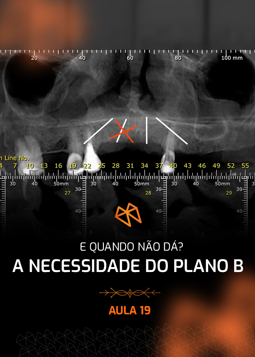 FPM 19 - E QUANDO NÃO DÁ_ A NECESSIDADE DO PLANO B